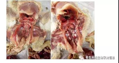 腎傳支