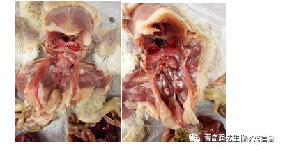 腎傳支治療案例