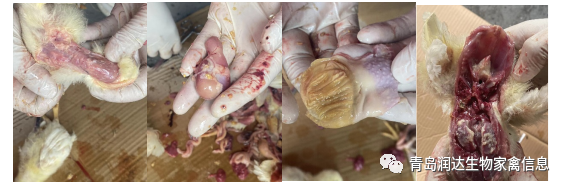 免疫抑制病引起頑固性腺肌胃炎的治療成功案例